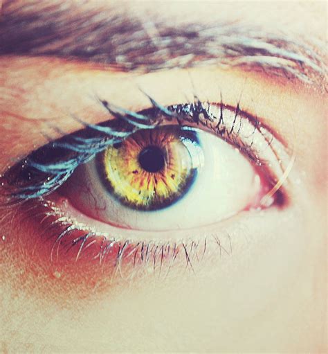 Heterochromia Iridum - Stunning Eyes