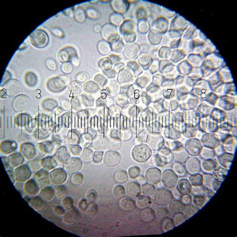 Saccharomyces cerevisiae - microbewiki