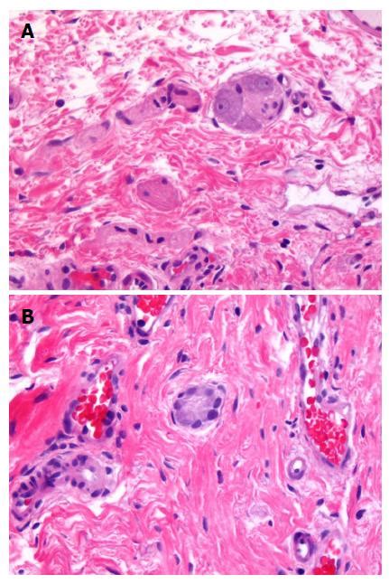 Hirschsprung’s disease: Historical notes and pathological diagnosis on the occasion of the 100th ...