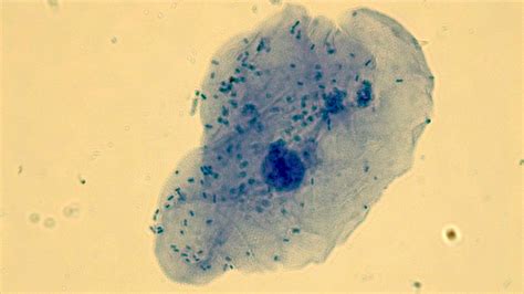 Micrograph human cheek epithelial cells methylene blue 1000X p000017 ...