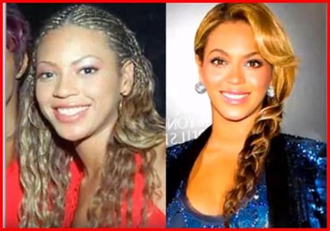 Beyonce Plastic Surgery Photos - Celebrities Plastic Surgery