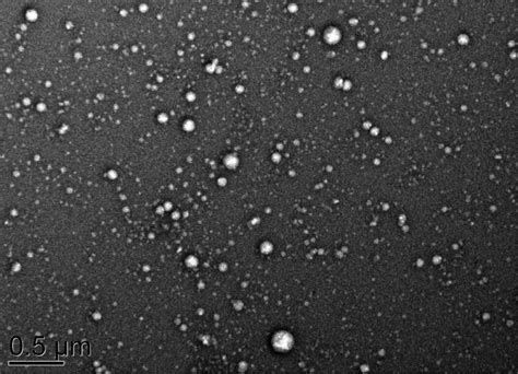 Morphology of exosome under TEM (uranyl acetate staining): Bar = 500 nm. | Download Scientific ...