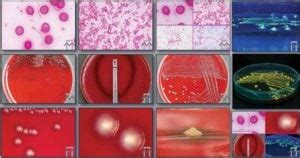 Biochemical Test of Fusobacterium necrophorum