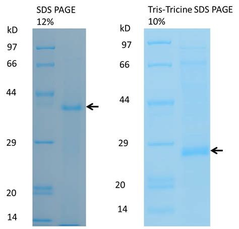 Sds Page Lysis Buffer Recipe | Bryont Blog