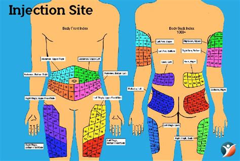 Insulin Injection Sites Diagram Printable - Printable Templates