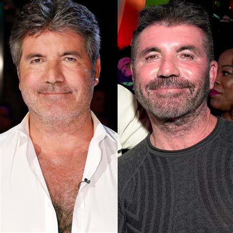 Simon Cowell Removes His Face Fillers After Saying He Went “Too Far”