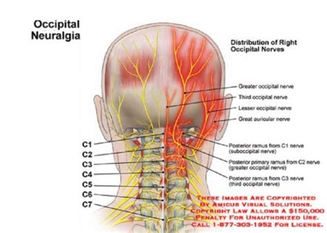 What is Occipital Neuralgia? BY:Wyatt Redd One of the worst things about fibromyalgia, besides ...