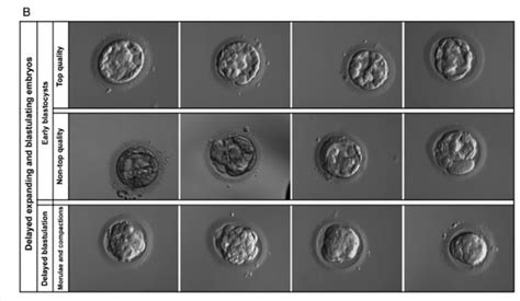 Embryo Grading - Quality Chart and IVF Success Rates