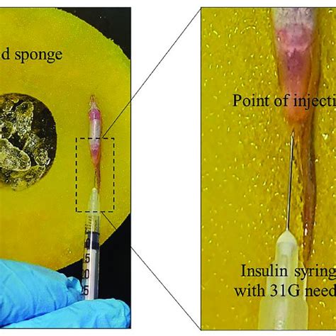 Representative diagram of the experimental setup for intraperitoneal ...