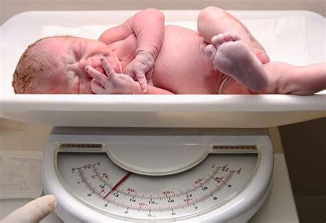 Complications Associated With Babies Born at 36 Weeks