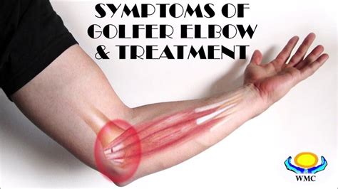 THE BEST TREATMENT FOR GOLFER ELBOW IN IPOH - YouTube