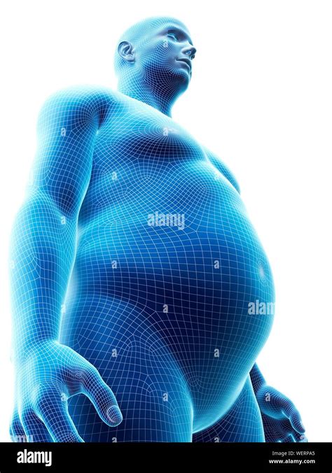 Obese man, illustration Stock Photo - Alamy