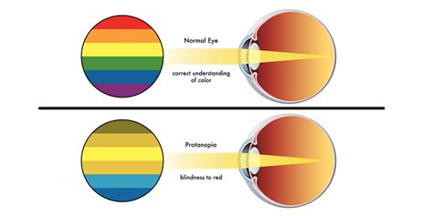 Penyakit Buta Warna Total vs Buta Warna Parsial • Deherba.com