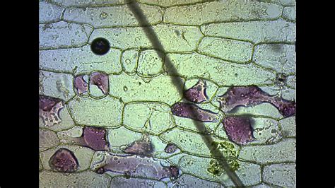 Red Onion Plasmolysis and Cytolysis - YouTube