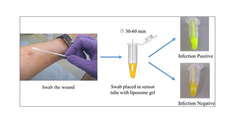 SPaCE Swab: Point-of-Care Sensor for Simple and Rapid Detection of ...