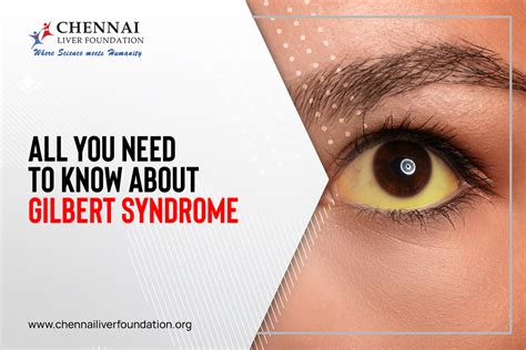 All You Need To Know About Gilbert Syndrome - Chennai Liver Foundation