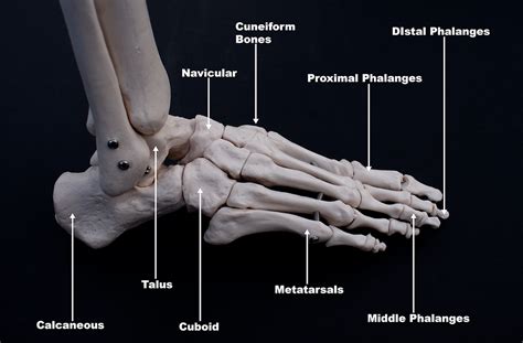 Lateral Foot Pain - Cuboid Syndrome