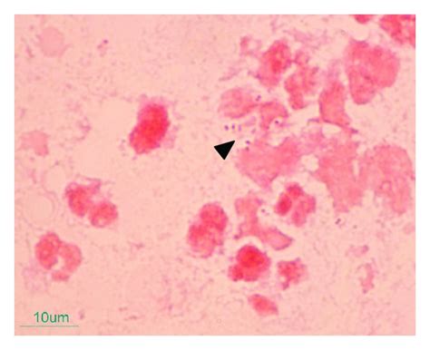 Neisseria Gram Stain