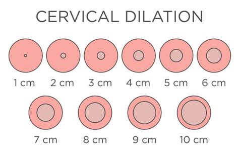 Cervix Dilation Chart: Signs, Stages And Procedure To Check | Cervix ...