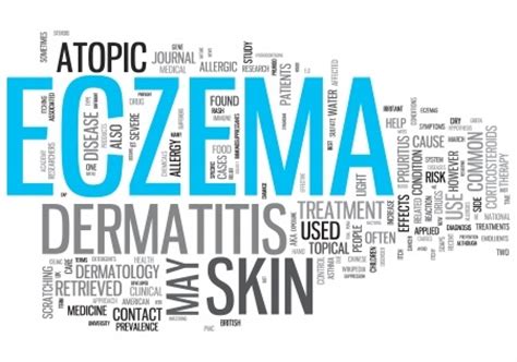 Pompholyx Eczema: Symptoms, Causes and Treatment - Eczema Free Skin