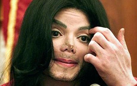 Michael Jackson: the operations that ruined his face