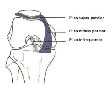 Knee Plica (Synovial) Syndrome: Symptoms, Causes, Treatment | Orthopaedic Doctor in Mumbai | Dr ...