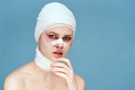 Portrait of a Woman Bruised Face Medicine Treatment Injury Isolated ...