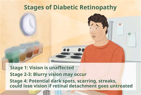 Diabetic Retinopathy Stages