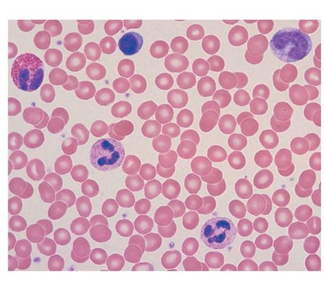 Human Blood Smear Diagram | Quizlet