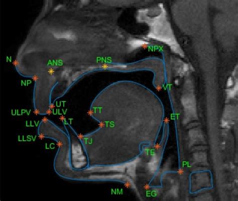 Vocal tract landmarks from MRI image Courtesy of (Eslami et al., 2020 ...