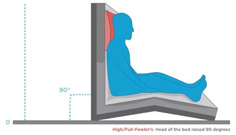 Fowler’s position, uses for Fowler’s position