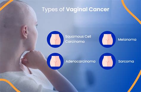 Vaginal Cancer: Everything You Need To Know | ACTC