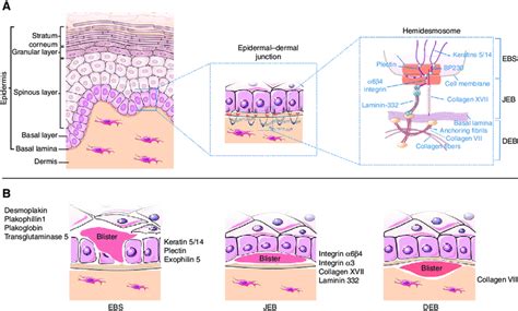 Schematic representation of human skin and epidermolysis bullosa (EB).... | Download Scientific ...