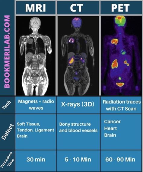 PET and SPEC Scans: Nuclear Imaging Simplified