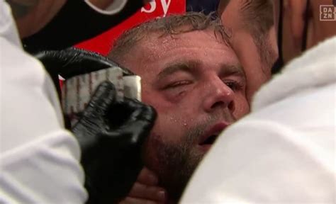 Billy Joe Saunders quits against Canelo Alvarez with swollen eye