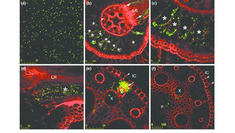 Confocal laser scanning microscopy of gfp-tagged Enterobacter gergoviae ...