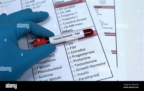 Female hormone, doctor showing blood sample tube, lab research, health checkup Stock Photo - Alamy