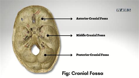 Cranial Fossa: Contents, Anatomy and Clinical Significance - WOMS