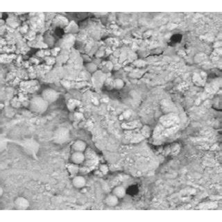 Biofilm formation by Enterococcus faecalis in the intracanal after (a)... | Download Scientific ...