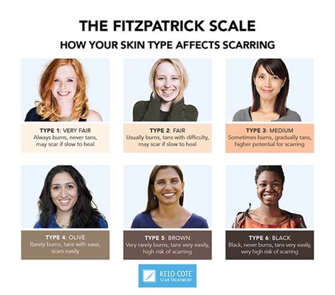 Fitzpatrick Skin Types | The Devonshire Clinic