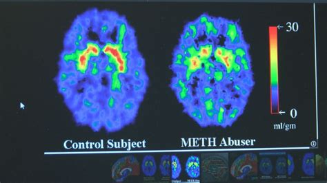 Expert explains how meth can affect brain | KECI