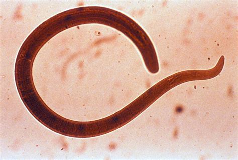 BIOLOGI GONZAGA: ASCARIS LUMBRICOIDES