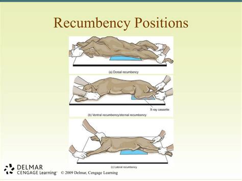 What Is Recumbent Position