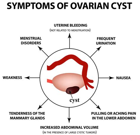 Ovarian Cysts: What Are They & What Are The Treatment Options?