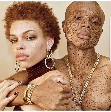 A brief--> analysis of... MELANIN ... All HUEmans are meant to... HAVE MELANIN AKA CARBON DARK ...