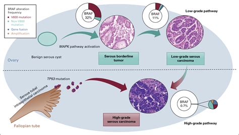 Spectrum of BRAF Mutations and Gene Rearrangements in Ovarian Serous Carcinoma | JCO Precision ...