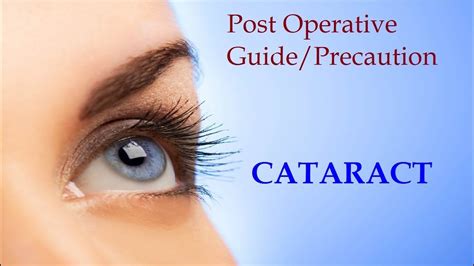 A Guide on What to Do After Cataract Eye Surgery – Last Seen