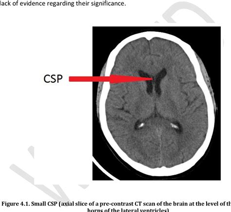 The prevalence of cavum septum pellucidum in brain imaging of mental health referrals in a South ...