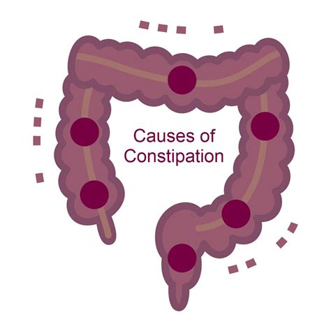 Causes of Constipation - Best Colon Enemas