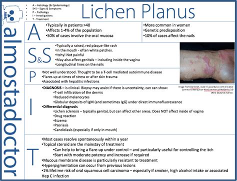 Lichen Planus Types